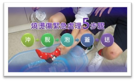 燒燙傷緊急處理步驟